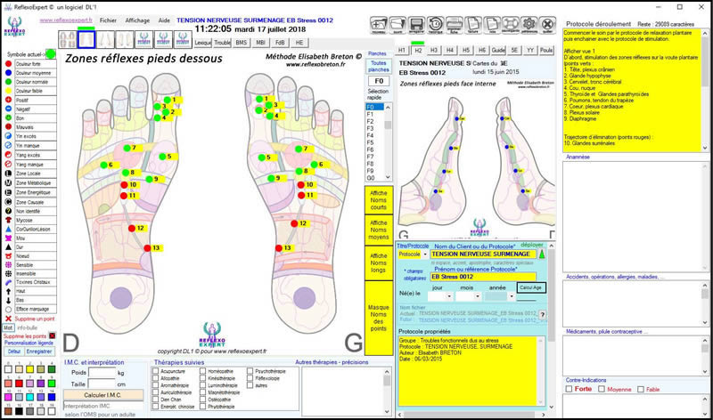 Protocoles ReflexoEXPERT